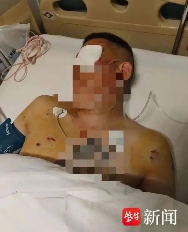 波士顿凯尔特人 vs纽约尼克斯
_男子取170万元现金银行门口遭抢波士顿凯尔特人 vs纽约尼克斯
，工作人员无动于衷