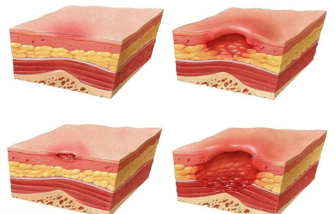 金州女武神vs纽约自由人
_一觉醒来金州女武神vs纽约自由人
,21岁女生的屁股惨不忍睹!严重或危及生命