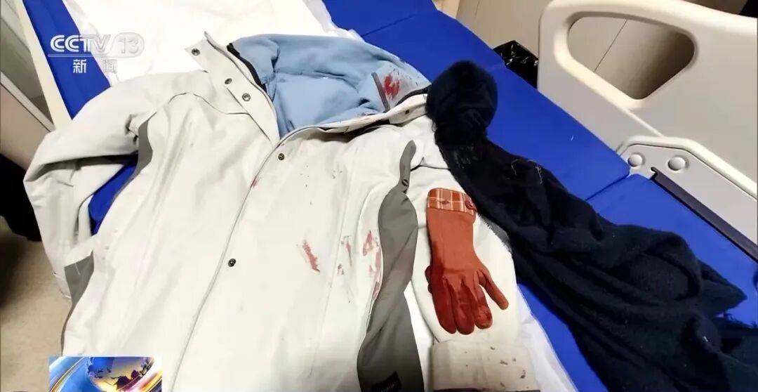 皇冠投注
_女警徒手夺刀皇冠投注
,脸上缝30多针:后怕但不后悔